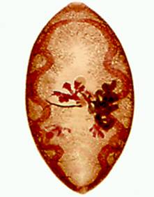图1-1卫氏并殖吸虫成虫和虫卵